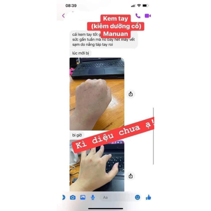 💦 KEM TAY ĐẶC HAND TREATMENT - CATHY CHO MÙA KHÔ HANH