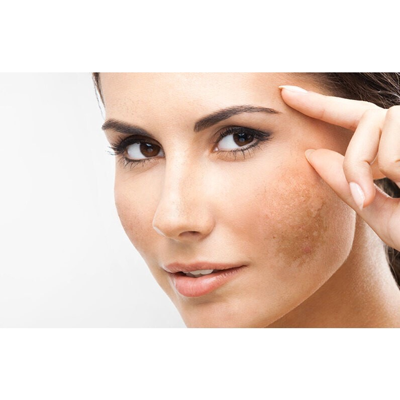 Tinh Chất Làm Trắng Da Tăng Cường SOSKIN Intense Clarifying Serum 30ml