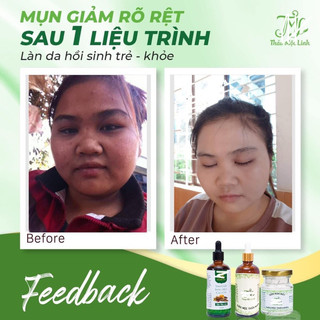 [CHÍNH HÃNG] TINH CHẤT THẢO MỘC LINH.