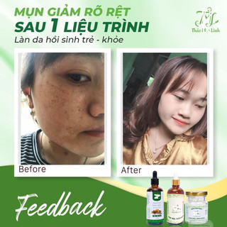 [CHÍNH HÃNG] TINH CHẤT THẢO MỘC LINH.