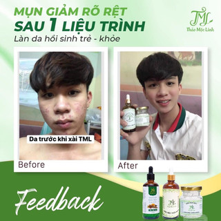 [CHÍNH HÃNG] TINH CHẤT THẢO MỘC LINH.