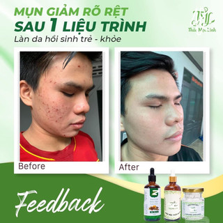 [CHÍNH HÃNG] TINH CHẤT THẢO MỘC LINH.