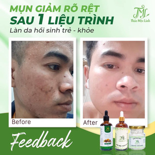 [CHÍNH HÃNG] TINH CHẤT THẢO MỘC LINH.