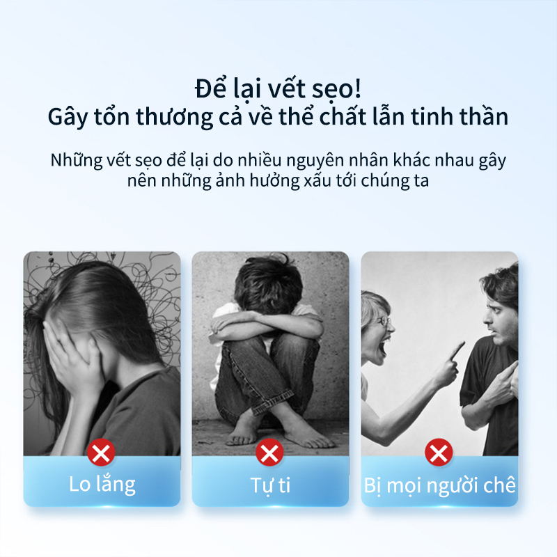 kem bôi sẹo kem mờ sẹo thâm scargel 30g vết thương sau phẫu thuật, vết rạn da tăng sản sẹo