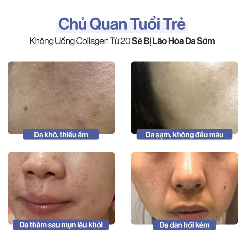 Bột Uống Collagen Cao Cấp Kết Hợp Saffron Gilaa (60 gói x 2g)