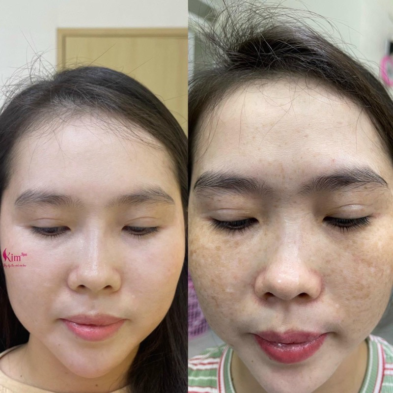 Kem Tái Tạo Da Đông Y 30Gram Kim Spa Cao Cấp Loại 1 Chuẩn Hàng Spa