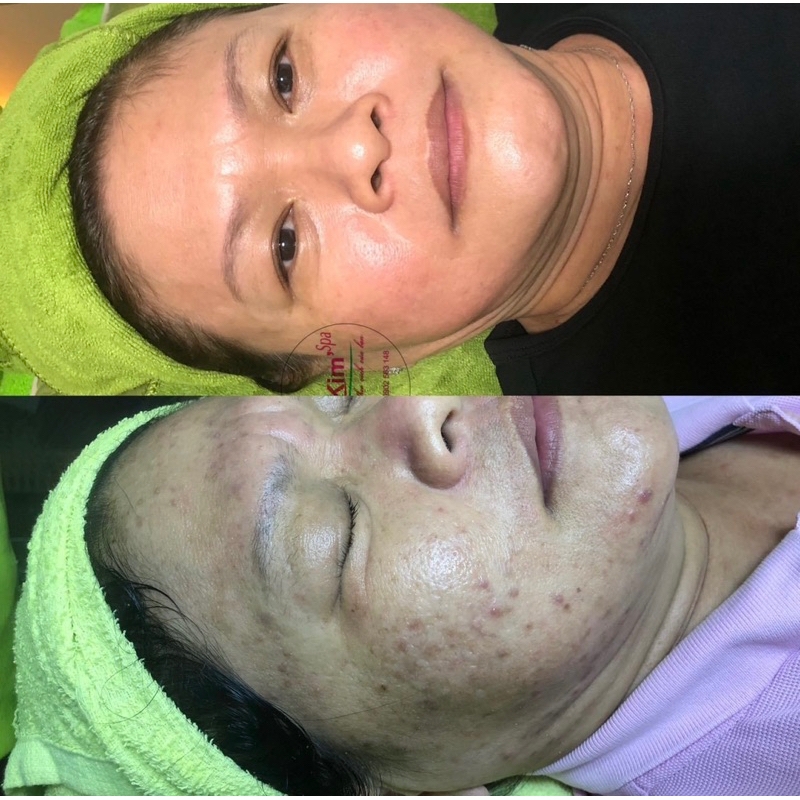 Kem Tái Tạo Da Đông Y 30Gram Kim Spa Cao Cấp Loại 1 Chuẩn Hàng Spa