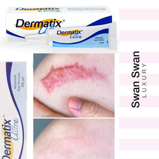 Dermatix ultra mỹ gel làm mờ sẹo thâm, sẹo lồi, sẹo lõi, sẹo lâu năm 7g