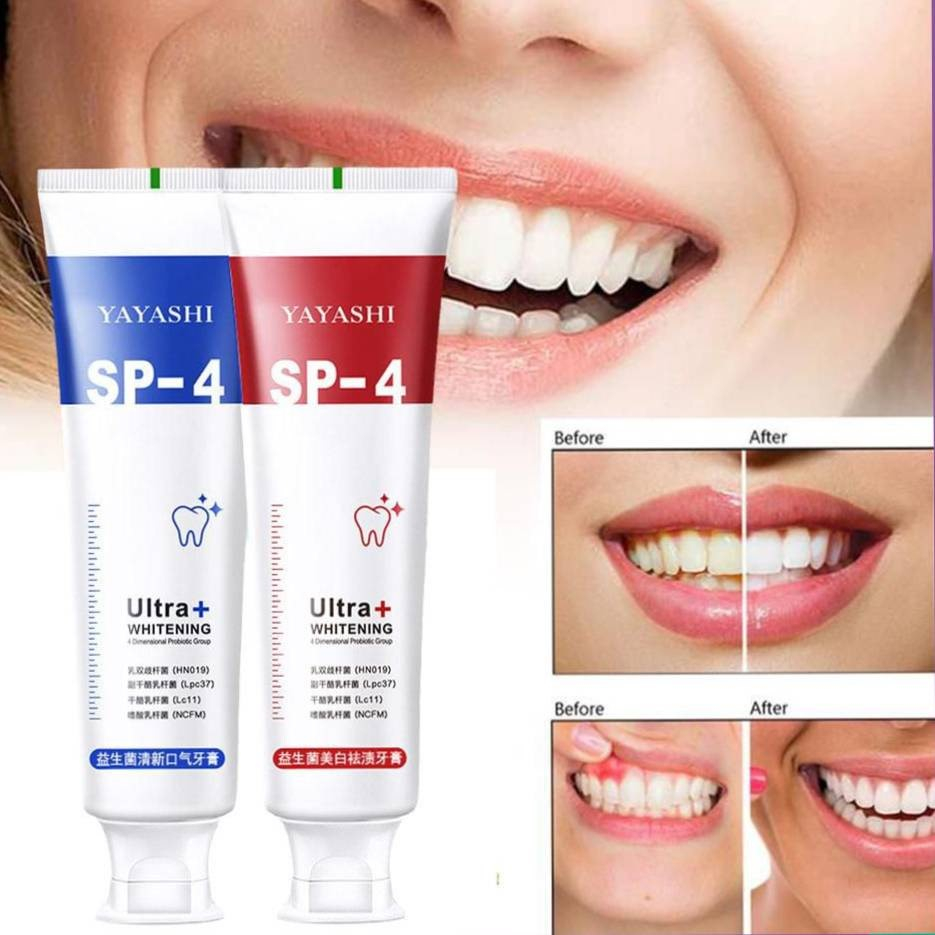 Kem Đánh Răng Yayashi Làm Trắng Răng, Loại Bỏ Mảng Bám , Ố Vàng Hương Bạc Hà