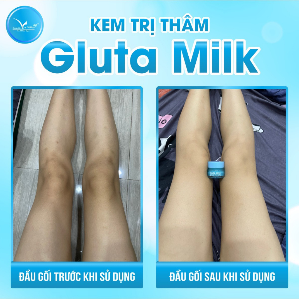 Kem Giảm Thâm Nách, Thâm Mông, Đầu Gối, Khuỷu Tay GLUTAMILK- 15Gr, Chính Hãng Thái Lan