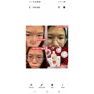 Combo bộ làm sạch của AA Cosmetic