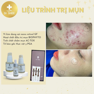 Bộ sản phẩm cho da mụn,  dầu (Biophito) Drshee