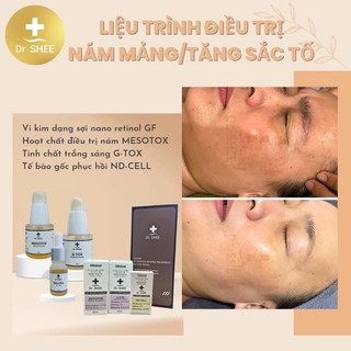 (Mẫu mới)Bộ phân giải sắc tố melanin (MESOTOX) của Dr.Shee 20ml