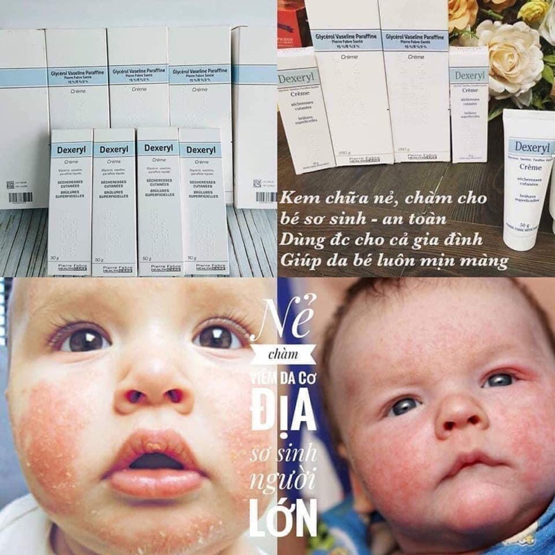 Kem dưỡng Dexeryl Cream date xa