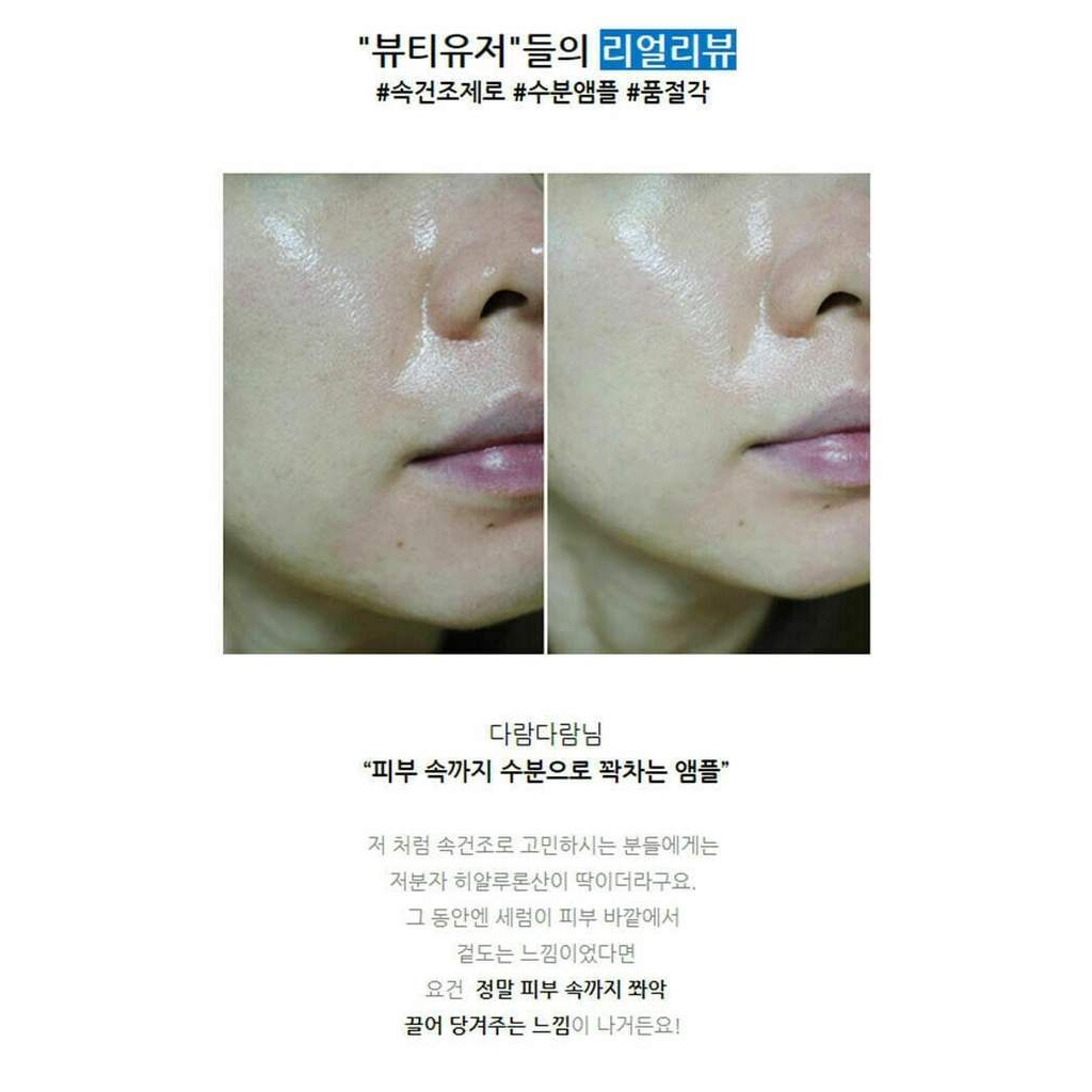 Tinh chất dưỡng ẩm Torriden Dive-in low molecule hyaluronic acid serum 50ml