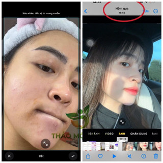 Thảo mộc xanh x5 (𝐂𝐡𝐢́𝐧𝐡 𝐡𝐚̃𝐧𝐠 & 𝐟𝐫𝐞𝐞𝐬𝐡𝐢𝐩)