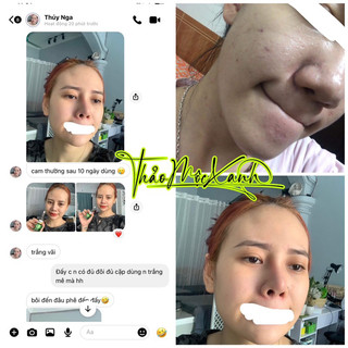 Thảo mộc xanh x5 (𝐂𝐡𝐢́𝐧𝐡 𝐡𝐚̃𝐧𝐠 & 𝐟𝐫𝐞𝐞𝐬𝐡𝐢𝐩)