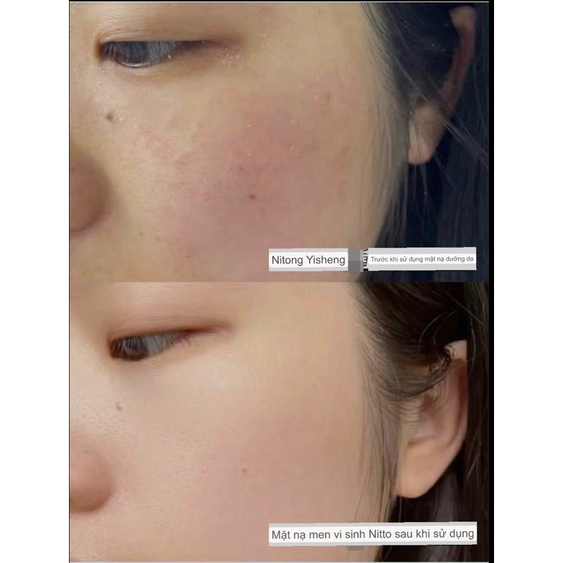 Combo 10m Mặt nạ cao cấp Ildong Probiotic Mask 25gx10