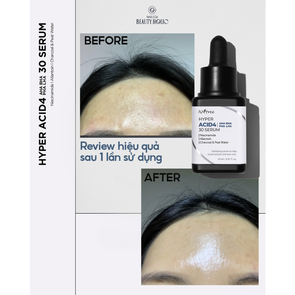 Serum peel tẩy da chết ISNTREE HYPER ACID4 AHA BHA PHA LHA 30 SERUM