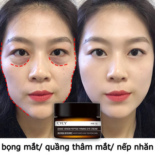 Kem dưỡng mắt làm giảm nếp nhăn/ giảm quầng thâm làm sáng ẩm cho da 30g