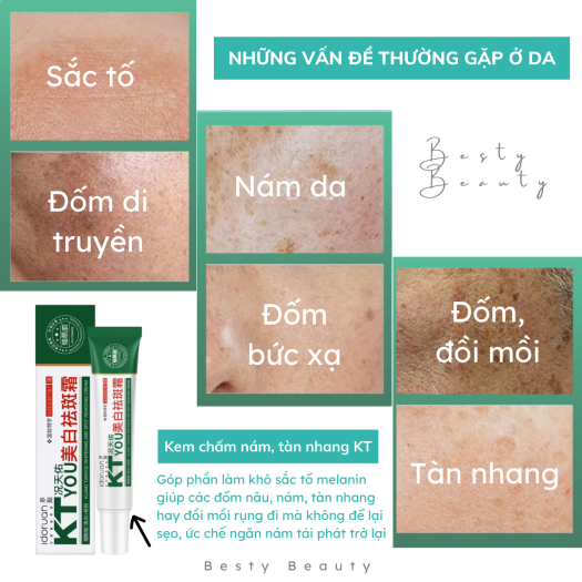 💕💕CHÍNH HÃNG💕💕 Kem Chấm Nám Tàn Nhang Đồi Mồi KT YOU Giúp Da Sáng Mịn 20g