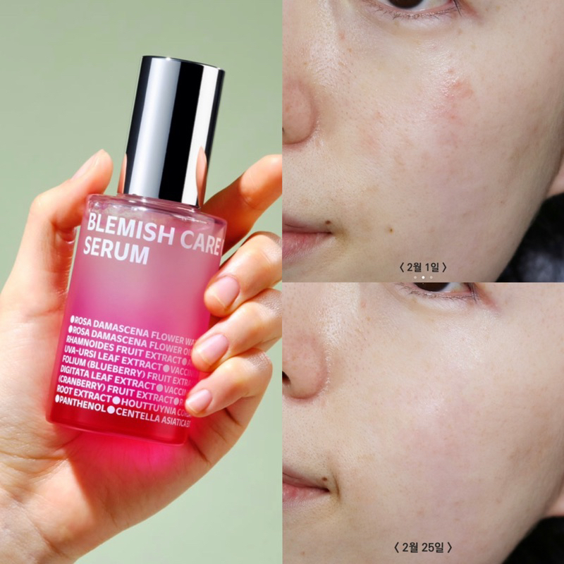 TINH CHẤT DƯỠNG SÁNG DA ISOI BLEMISH CARE SERUM 35ML