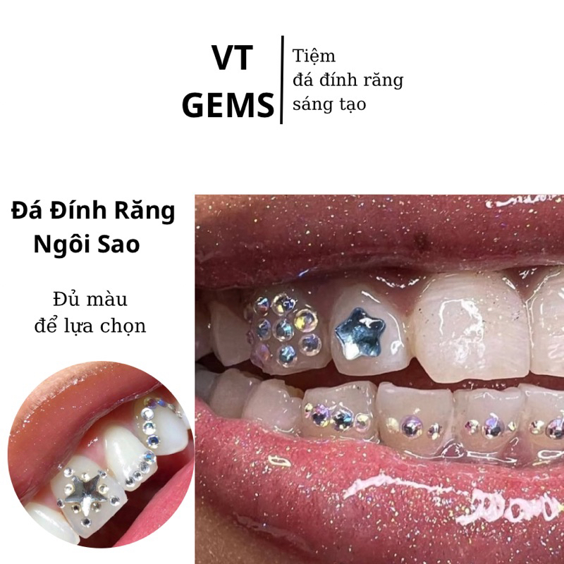 Đá Gắn Răng, Đá Đính Răng Hình Ngôi Sao