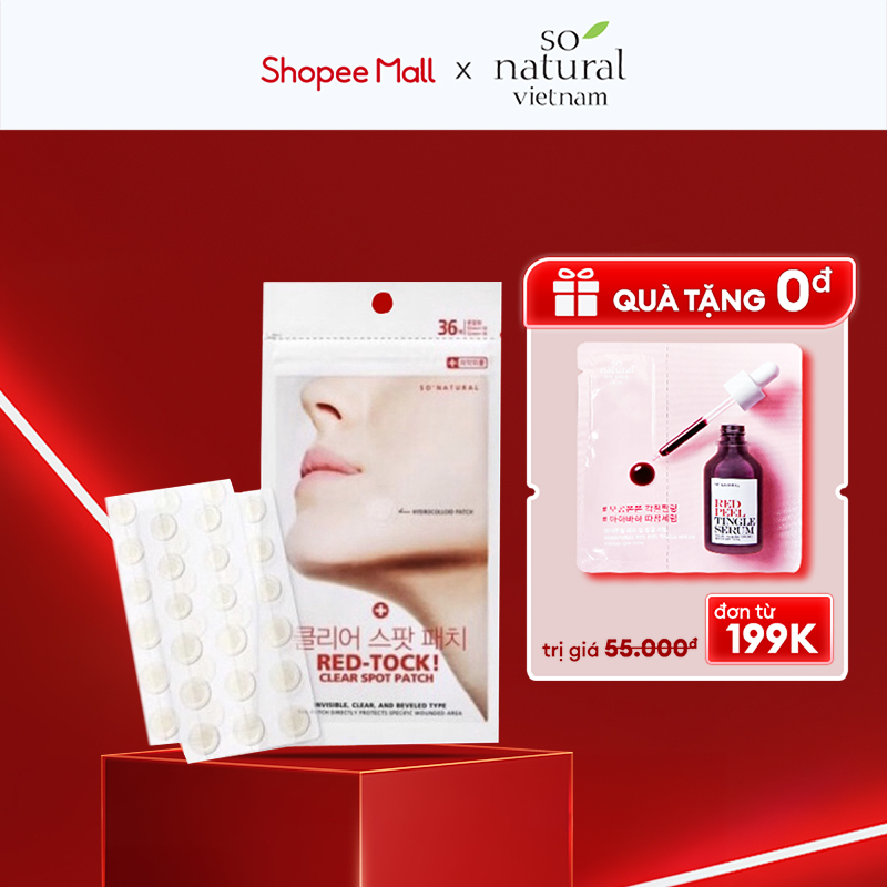 Miếng dán mụn So Natural bản 36 miếng