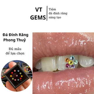 Đá đính răng, đá gắn răng màu phong thuỷ