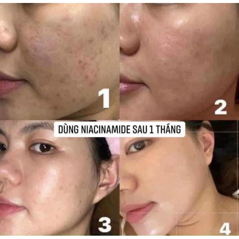 Tinh chất Sáng Da Mờ Thâm Oh.h 20% Niacinamide 10 ml