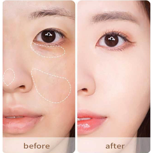 Thanh Che Khuyết Điểm SVMY Nhiệt Đới