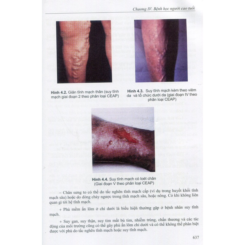 Sách - Bệnh học Nội khoa