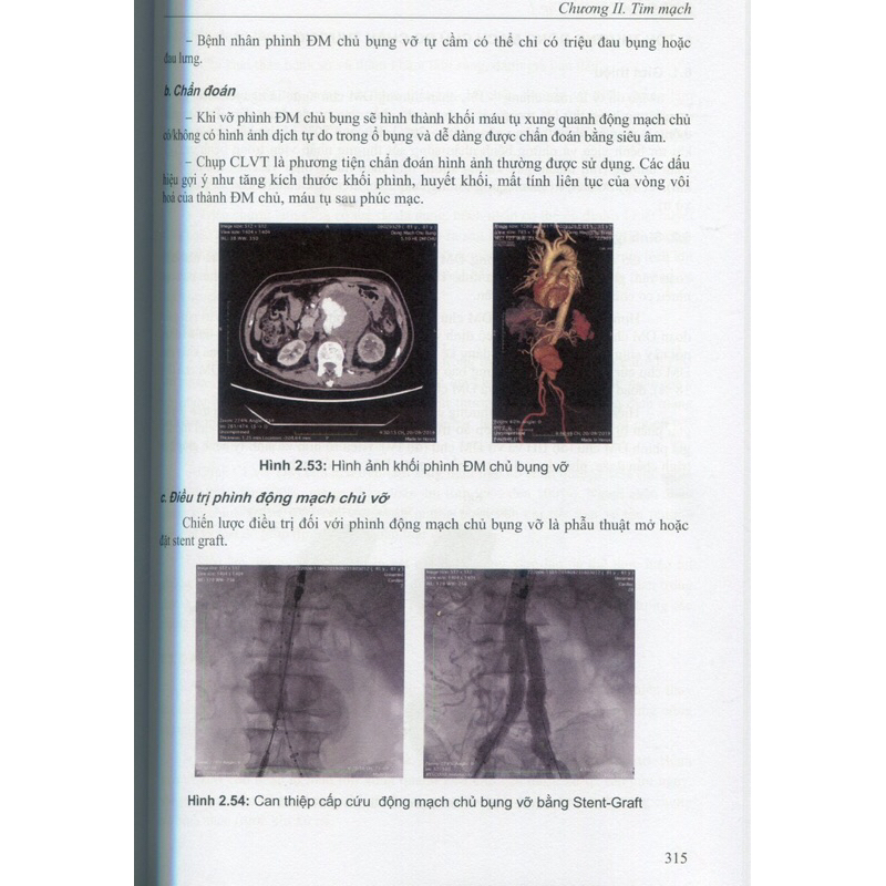 Sách - Bệnh học Nội khoa