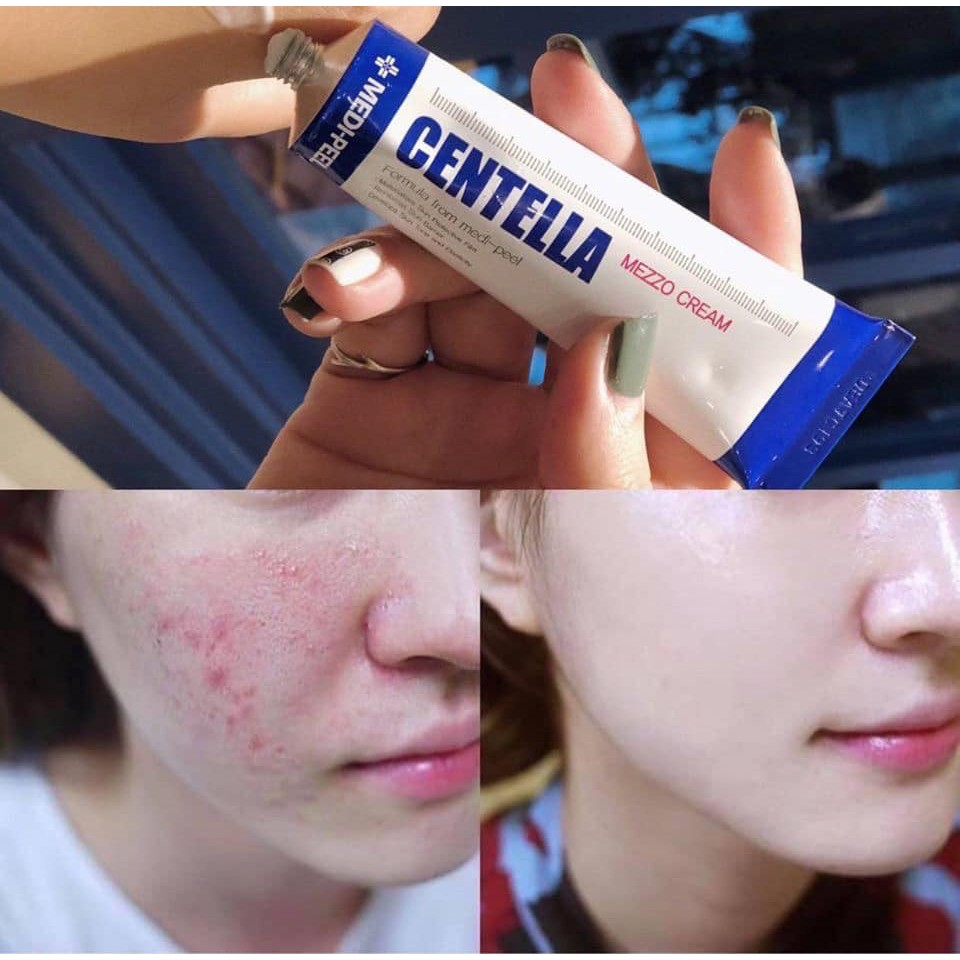 Kem dưỡng Medi-Peel Centella Mezzo Cream 30ml giúp giảm mụn, phục hồi da, làm dịu da. | BigBuy360 - bigbuy360.vn