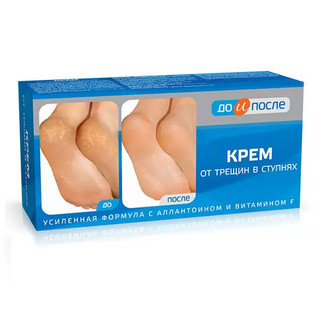 Kem chống nứt  gót chân  Foot cream for cracked heels-50ml, hãng TWINS TEC.