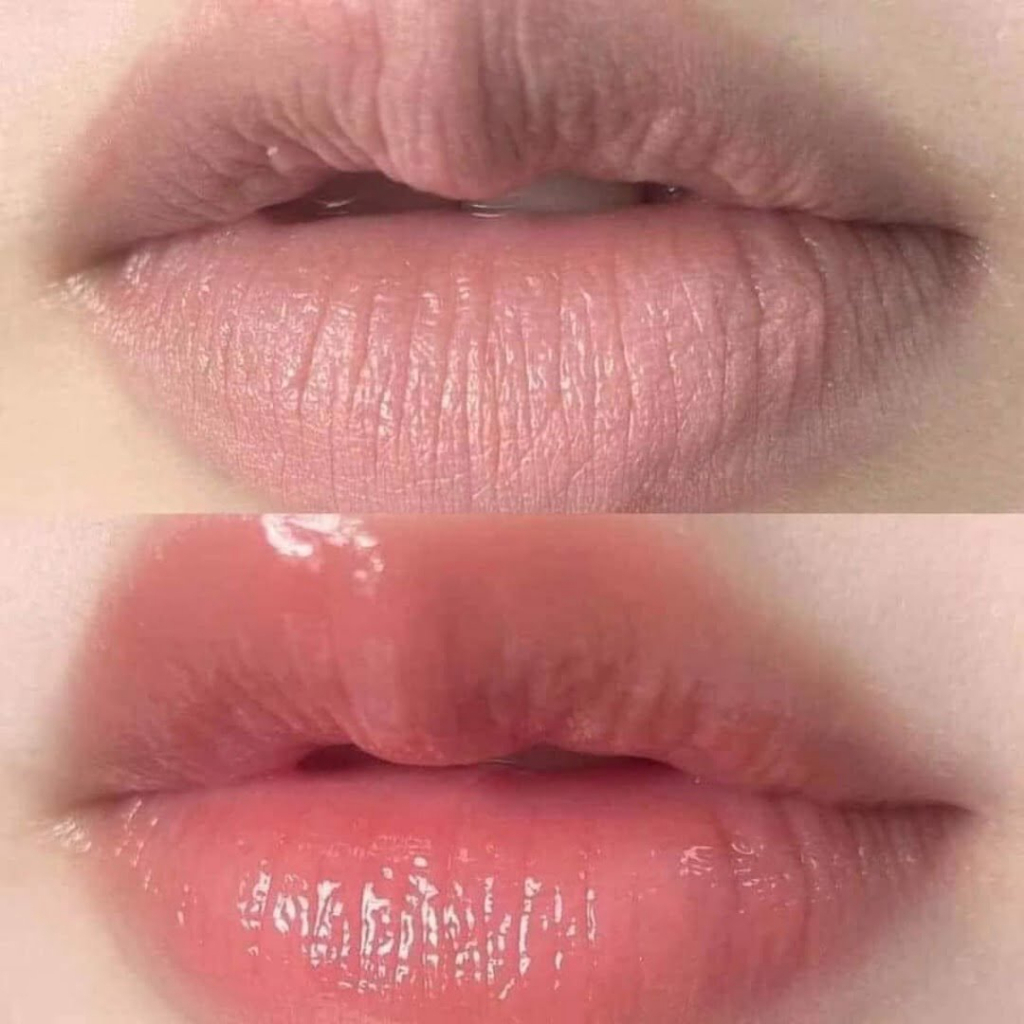 Son Dưỡng Mediheal Dùng cho môi thâm, bợt màu, khô nứt nẻ Mediheal Labocare Panteno Lips 10ml | Nine Hàn Nhật