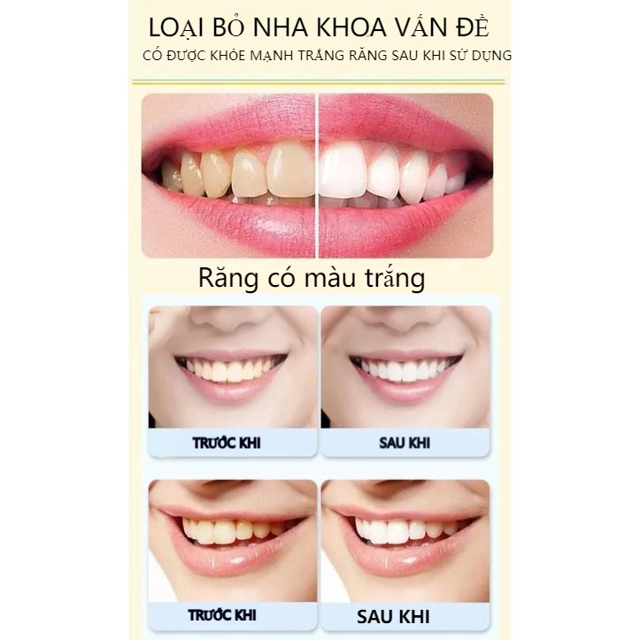 Kem Đánh Răng YAYASHI SP-4 Làm Trắng Răng Chính Hãng  Làm Trắng Hơi Thở Thơm Mát Nụ Cười Tự Tin