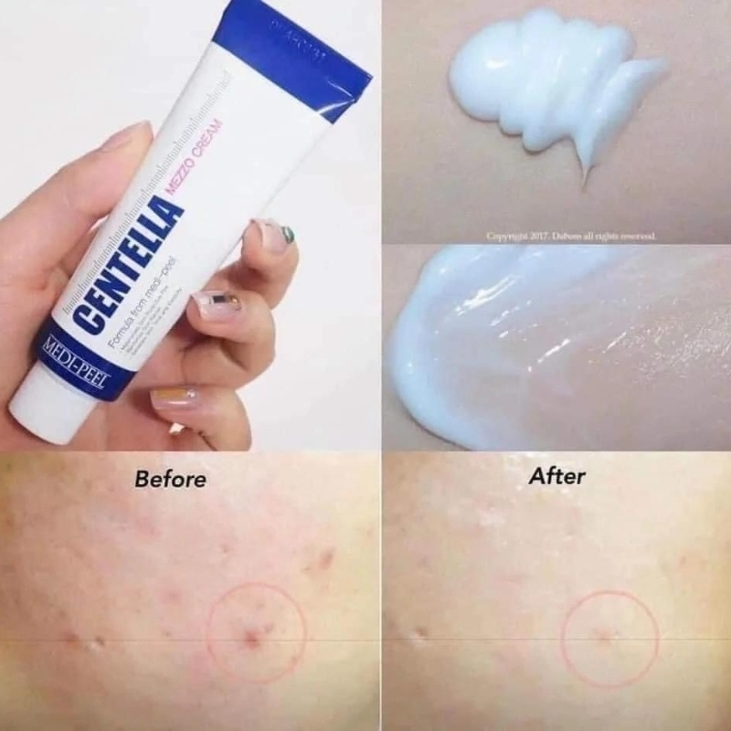 Kem Dưỡng Medi-Peel Centella Mezzo Cream Giúp Giảm Mụn, Phục Hồi Da, Làm Dịu Da 30ml | BigBuy360 - bigbuy360.vn