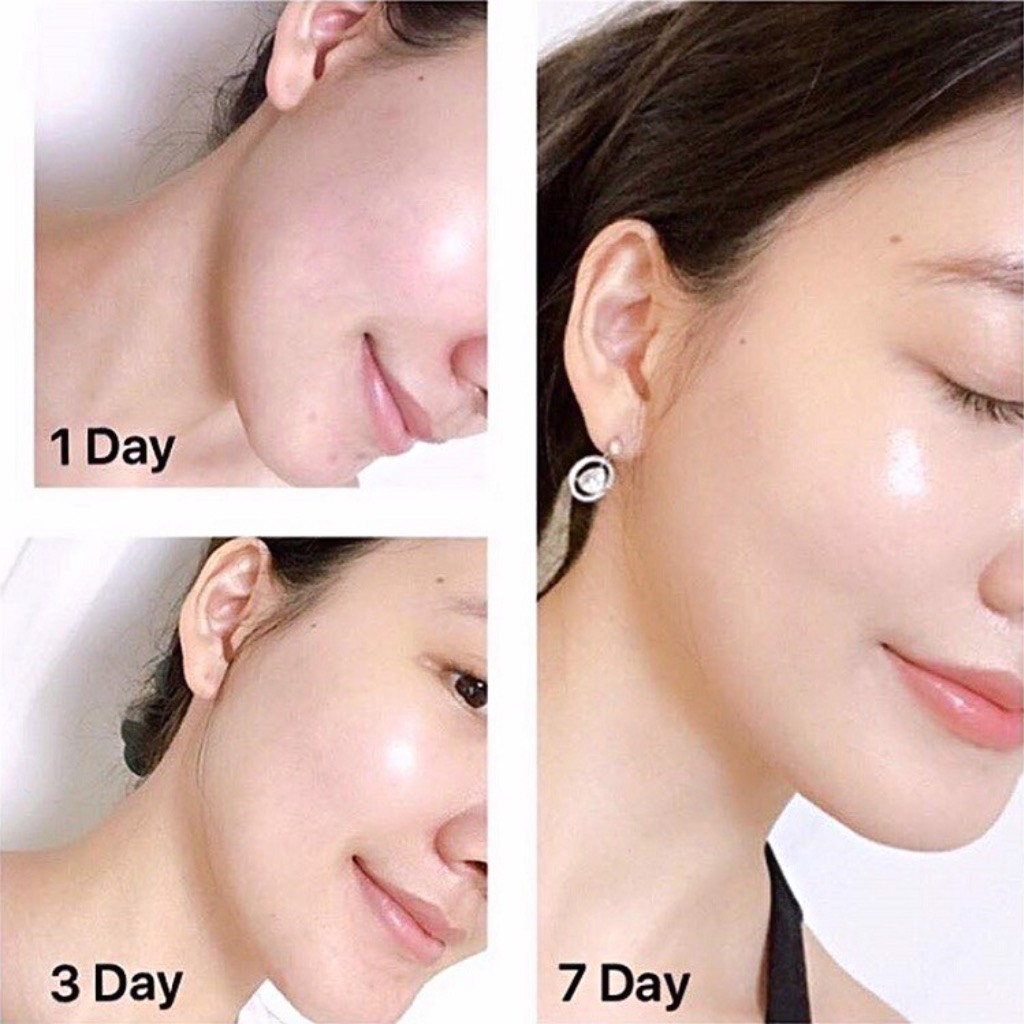 Kem Dưỡng Da Chống Lão Hóa OLAY Total Effects 7 in 1 Ngày & Đêm 50ml