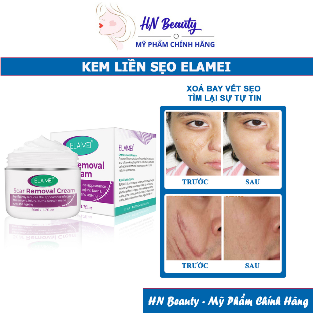 Kem Sẹo ELAIMEI Kem Xóa Mờ Sẹo Mờ Thâm Rạn Da Hỗ Trợ Xóa Mờ Sẹo Lồi Lõm Vết Rạn Da Giảm Sẹo Mụn Sẹo