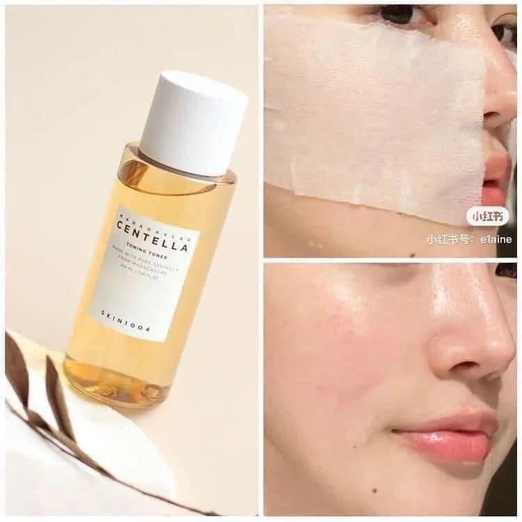 Nước hoa hồng rau má Madagascar Centella Asiatica Toning Toner Skin1004