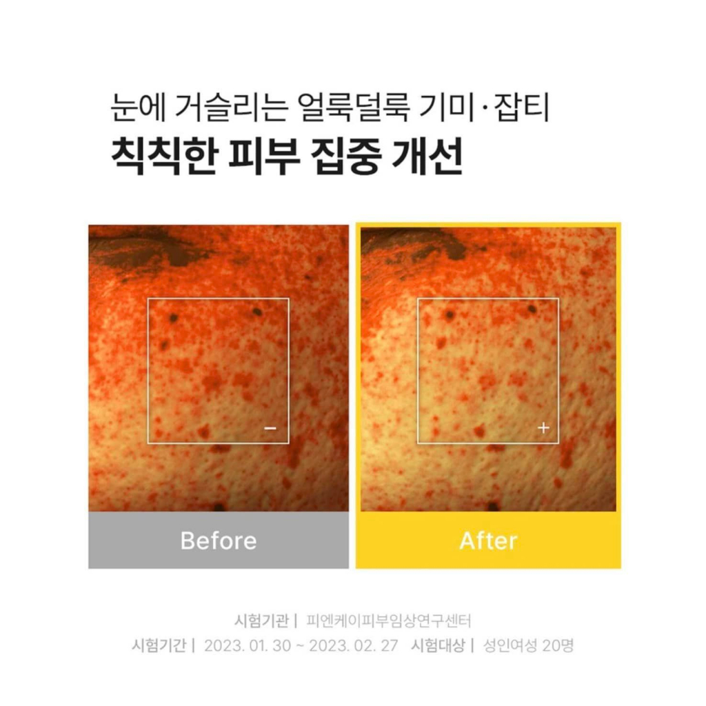 Tinh chất CELL FUSION C TONING C DARK SPOT SERUM dưỡng trắng mờ thâm nám 30ml SALE 70%