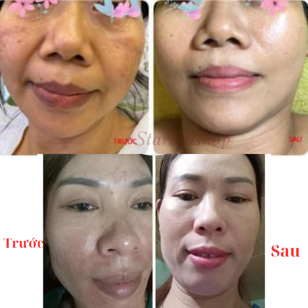 Viên uống trắng da Dr Lacir glutathione Plus, viên uống trắng da hủy nám, ngừa lão hóa, giảm nếp nhăn, hộp 30 viên
