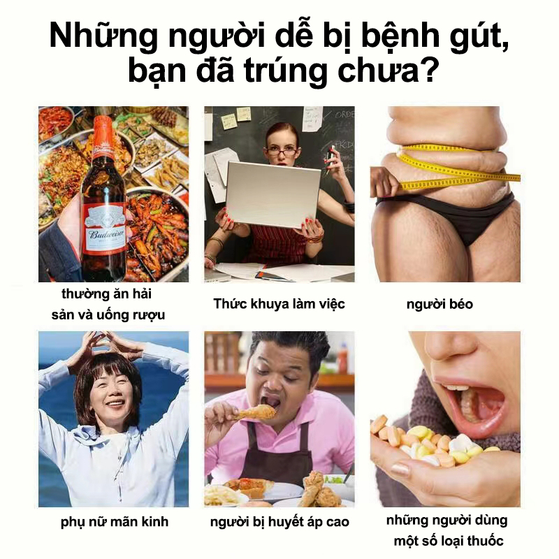Kem bệnh gout giảm nhẹ sưng khớp đau khớp Hạ axit uric Hòa tan hạt tophi đau đầu gối Giảm sưng Giảm đau 35g