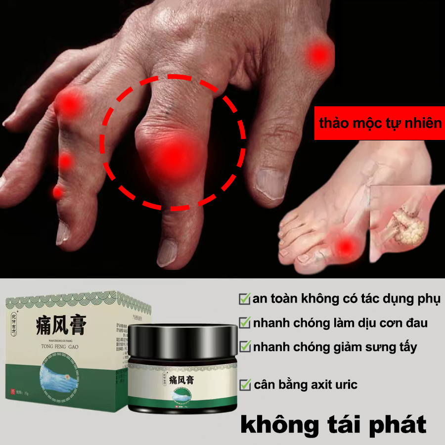 Kem bệnh gout giảm nhẹ sưng khớp đau khớp Hạ axit uric Hòa tan hạt tophi đau đầu gối Giảm sưng Giảm đau 35g