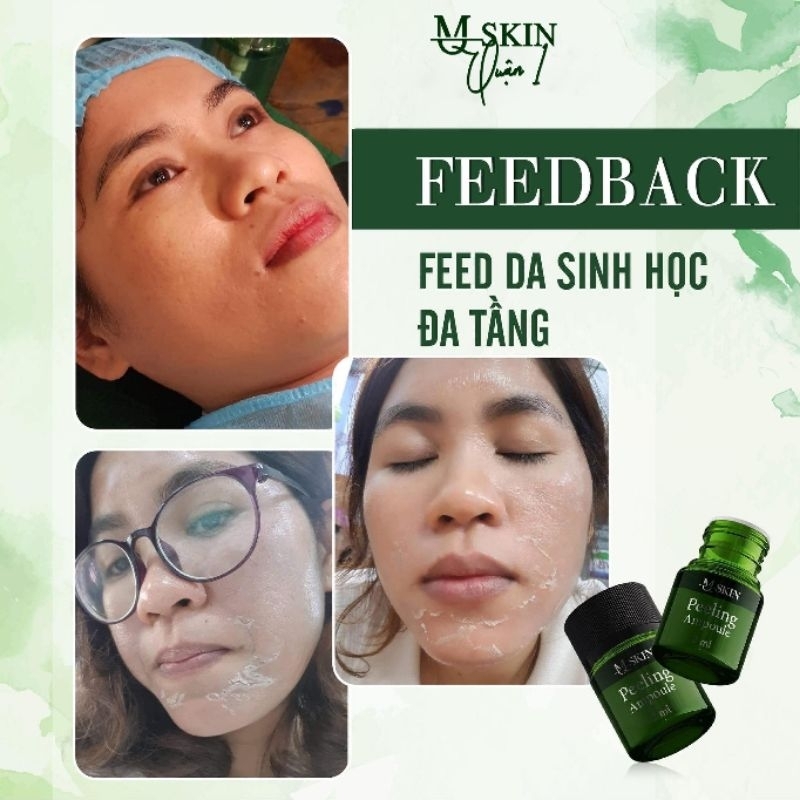 PEEL DA ĐA TẦNG SINH HỌC