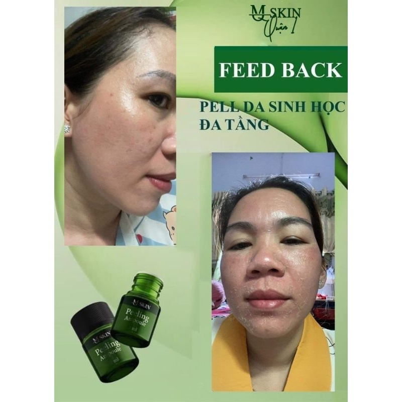 PEEL DA ĐA TẦNG SINH HỌC