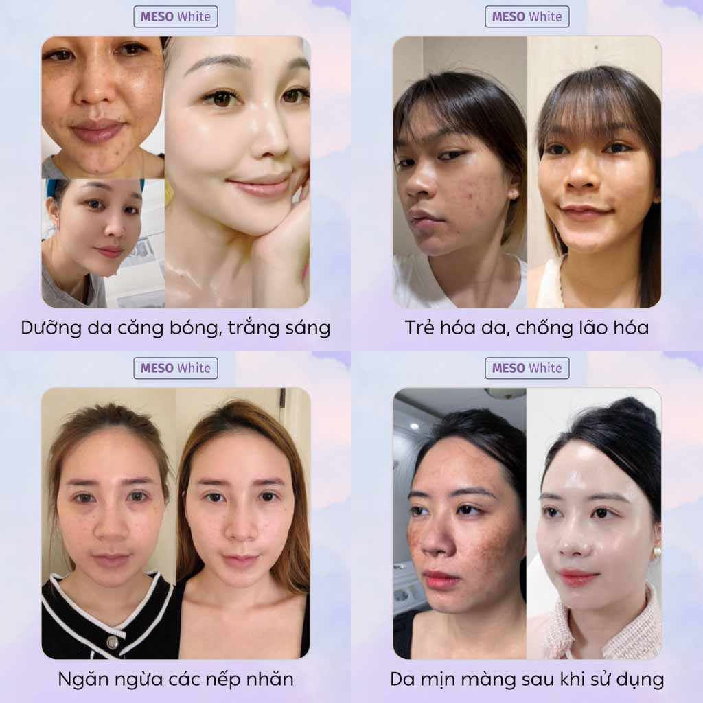 Serum Dưỡng Trắng Da Meso White dưỡng ẩm tại nhà thương hiệu SEYOUL