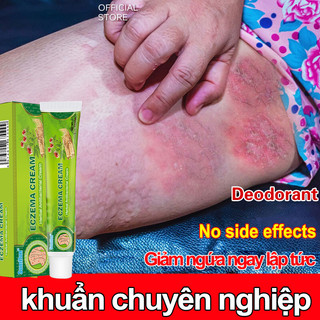 Kem bôi ngoài da kem chống ngứa vùng kín kem bôi hết sạch nấm ngứ 20g,chống ngứa viêm da, hắc lào, lang ben, mề đay