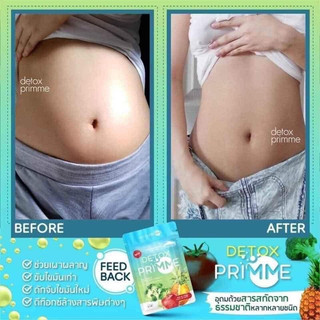DETOX PRIME DTX